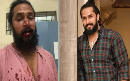 নাক-মুখ-ঠোঁট ফাঁটিয়ে দেয়া হলো অভিনেতার 