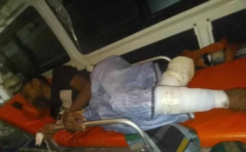 আরাকান আর্মির গুলিতে বাংলাদেশি জেলের পা বিচ্ছিন্ন 