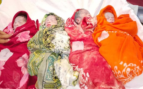 সাভারে একসঙ্গে ৪ কন্যাসন্তানের জন্ম 