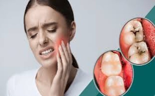 দাঁতের ক্ষয়, করণীয় কী? 