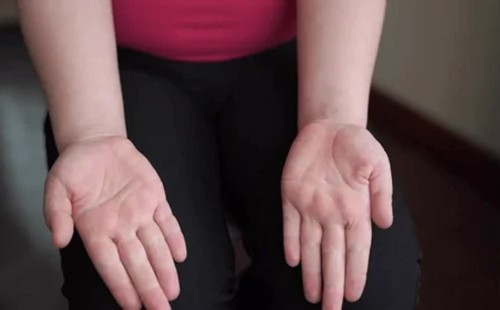 হাতের তালুতে লুকিয়ে থাকতে পারে শরীরের অসুস্থতার ইঙ্গিত, জেনে নিন 