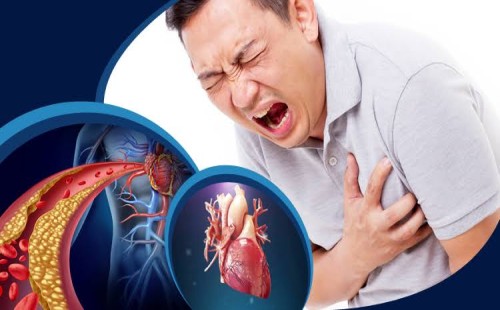 অতিরিক্ত মানসিক চাপে বাড়তে পারে হৃদরোগের ঝুঁকি 