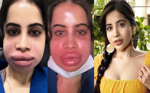 চেহারার এই হাল করলেন কেন উরফি? 