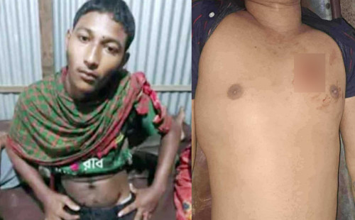 ব্রাহ্মণবাড়িয়ায় দু’পক্ষের গোলাগুলিতে আহত ৪ জন 