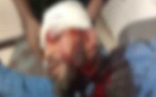 এবার এনসিপি নেতাকে প্রকাশ্যে গুলি 